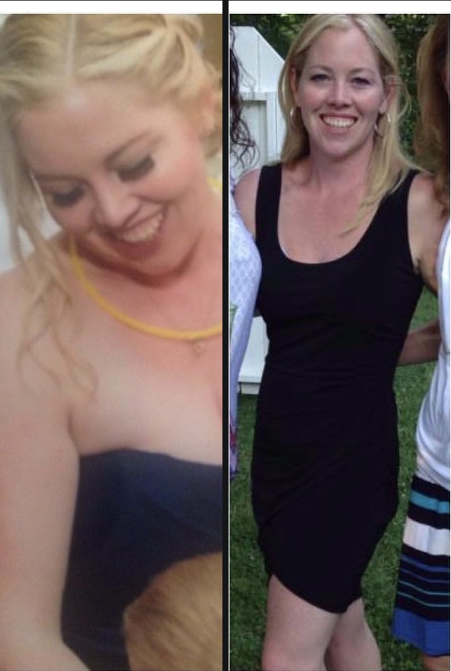 Client who lost 30 pounds, before and after photos